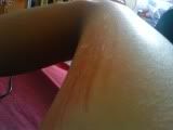 my scratch?